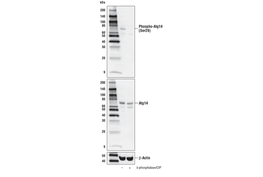 Western Blotting